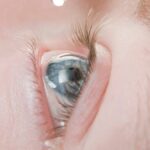 Millions of eye drops recalled. See list of affected products - USA Today
