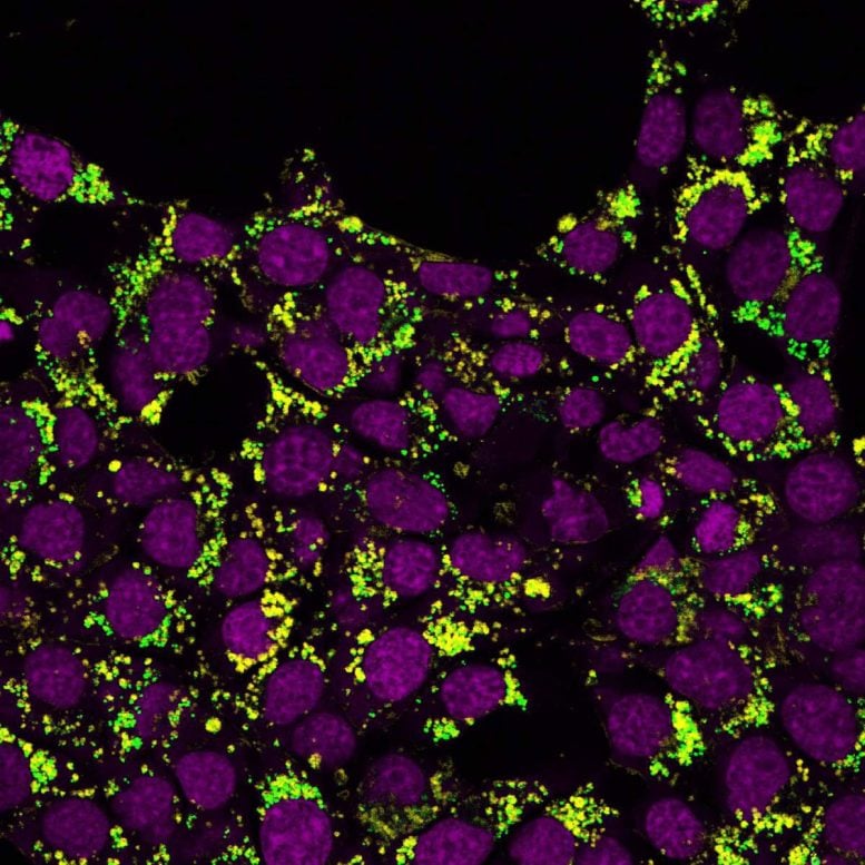 Viagra May Block a Hidden Pathway Cancer Cells Need To Spread - SciTechDaily