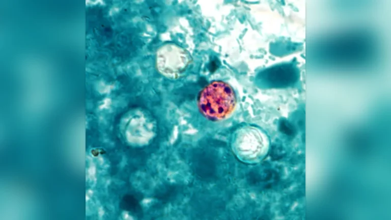 CDC warns of rising parasite infections with a horrifying symptom: 2026 cyclosporiasis outbreak spreads - Fast Company