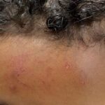 Visalia parents seek cameras in special ed rooms after unexplained injuries - kmph.com