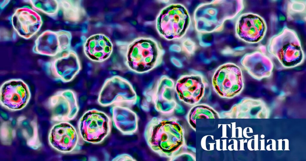 Two unvaccinated people die of measles in Pennsylvania - The Guardian