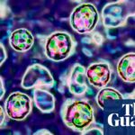 Two unvaccinated people die of measles in Pennsylvania - The Guardian