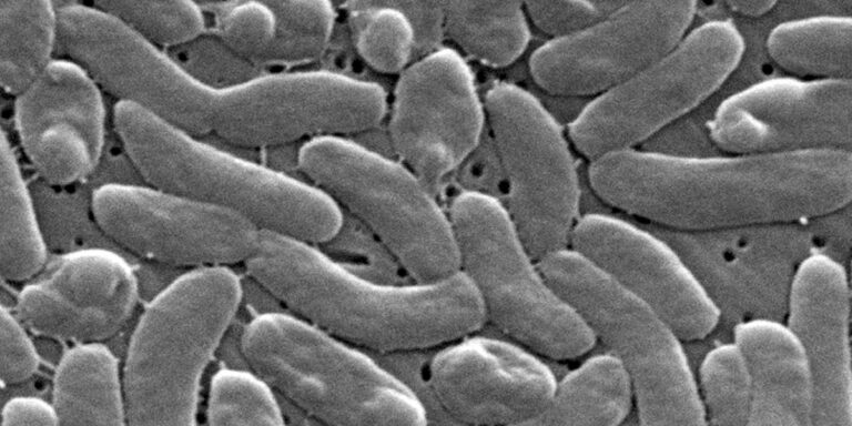 Flesh-eating bacteria infections are surging along the Gulf Coast with five deaths reported in Louisiana - Fortune