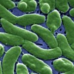 2nd flesh-eating bacteria death reported in Fla. this year - fox35orlando.com