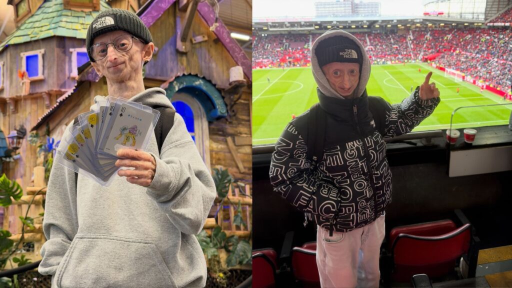 Belgian Twitch star Michiel Vandeweert, who defied a 12-year prognosis, dies at 28 - Soap Central
