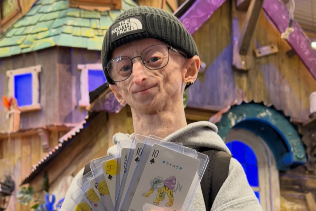 Who Was Michiel Vandeweert? Belgian Content Creator With Rare Progeria Condition Dies at 28 - International Business Times UK