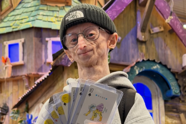 Who Was Michiel Vandeweert? Belgian Content Creator With Rare Progeria Condition Dies at 28 - International Business Times UK