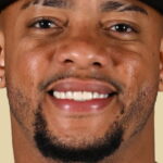 Diamondbacks place Ketel Marte on restricted list - NBC Sports