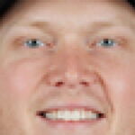 Mitch Keller done for season with shoulder injury - NBC Sports