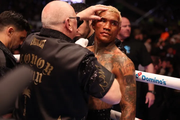 Conor Benn will follow Filip Hrgovic's lead and outlast Ryan Garcia, says Keith Connelly - BoxingScene