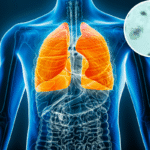 Scientists Studied Lung Cancer Patients—A Troubling Pattern Emerged - Newsweek