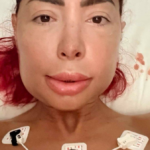 Farrah Abraham Recovers After Major Jaw Surgery Wired Mouth Shut - SuaraGarut.ID