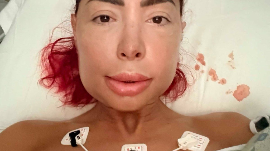 Farrah Abraham Recovers After Major Jaw Surgery Wired Mouth Shut - SuaraGarut.ID
