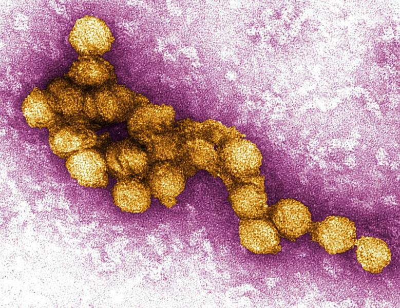Dane County confirms first human case of West Nile Virus this year - dailycardinal.com