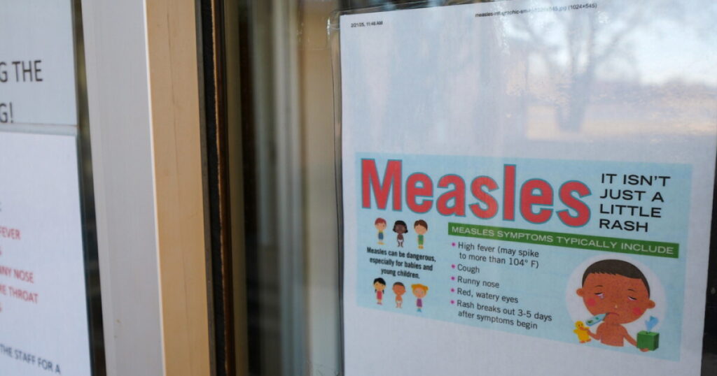 CA Dept. of Public Health notifies public of possible measles exposure related to train, bus passenger - 23ABC News Bakersfield