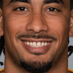 Packers collapse again, lose to Wentz-led Vikings - NBC Sports