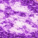 State health leaders sound alarm over high cases of measles in Laurel County - WKYT