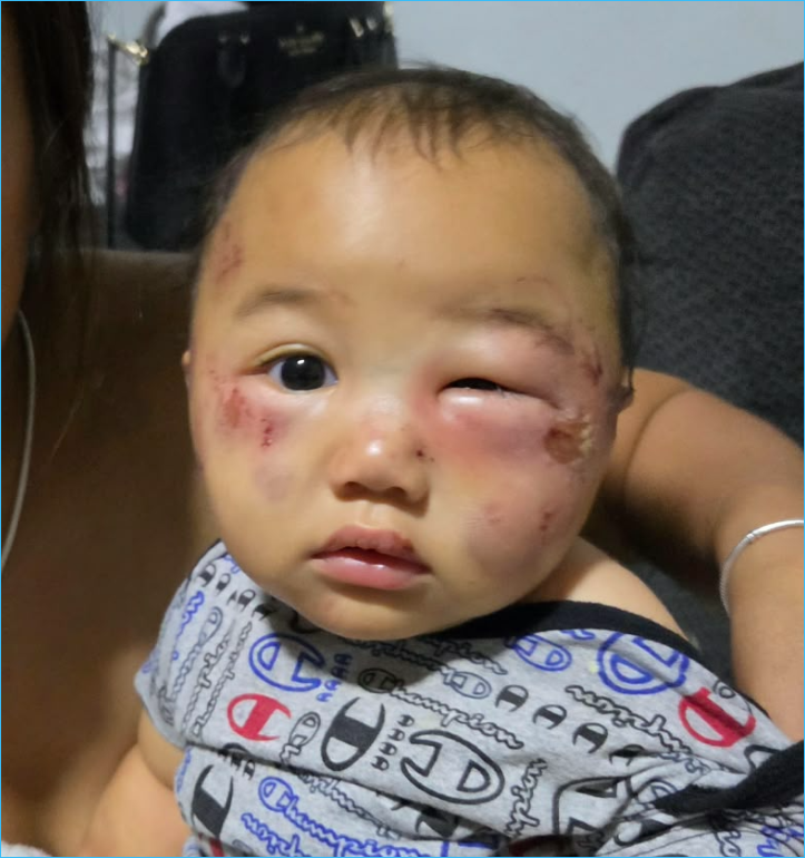 Baby boy badly injured at Tamuning daycare, mom and grandmother speak out - KUAM