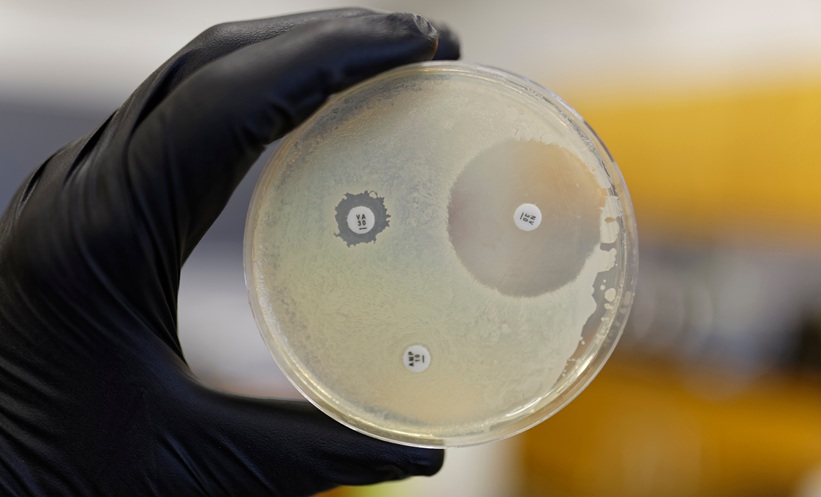 Salmonella Resistance May Help Probiotics Survive Antibiotics - EMJ