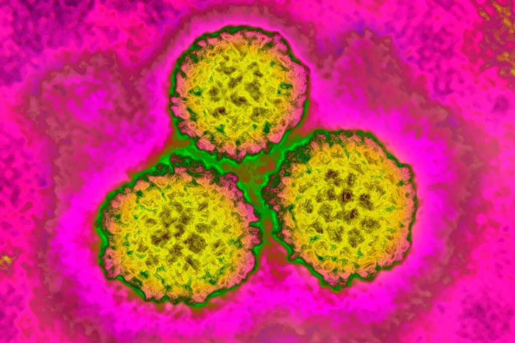 About 1 in 8 cancer cases worldwide are tied to these infections — most of them preventable - WRTV