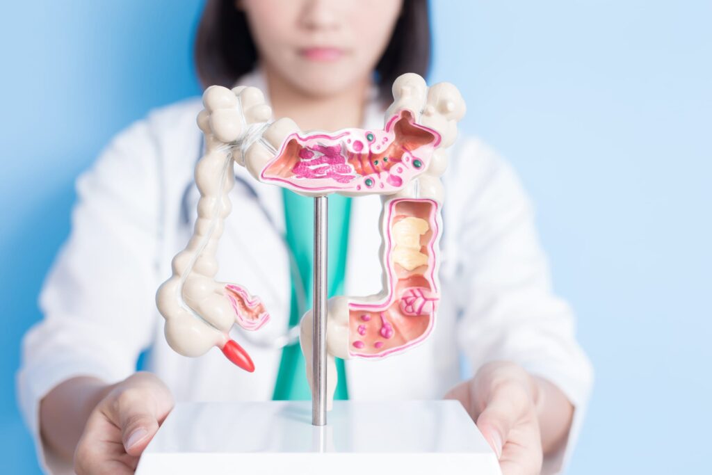 Haystack MRD Accurately Predicts Colorectal Cancer Recurrence, Study Finds - Clinical Lab Products
