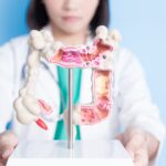 Haystack MRD Accurately Predicts Colorectal Cancer Recurrence, Study Finds - Clinical Lab Products