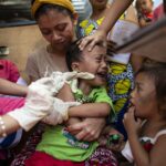 Nearly Always Fatal Measles Brain Disease Struck Some Philippine Children Just Two to Three Years After Infection - Medical Daily