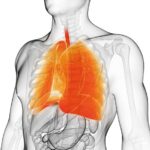 Radiotherapy boosts progression‑free survival in advanced lung cancer - PharmaTimes