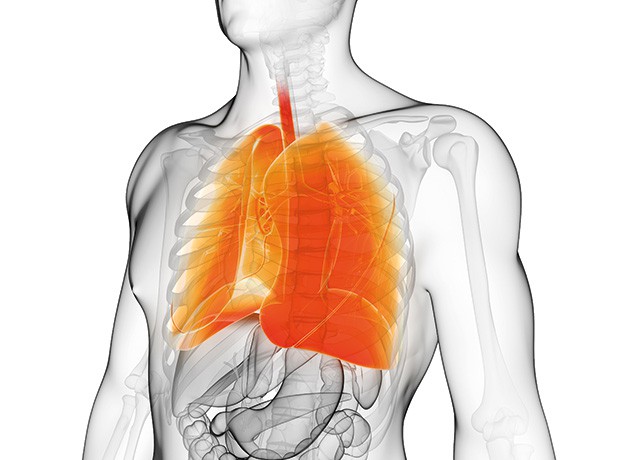 Radiotherapy boosts progression‑free survival in advanced lung cancer - PharmaTimes